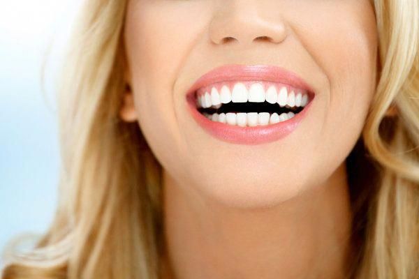 Виниры для зубов: 2 шага к голливудской улыбке